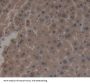 Mitogen-Activated Protein Kinase Kinase 7 (MAP2K7) Antibody