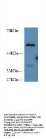Carboxypeptidase B2 / TAFI (CPB2) Antibody