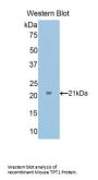 Tumor Protein, Translationally Controlled 1 (TPT1) Antibody