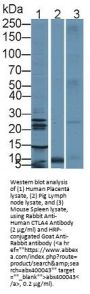 Cytotoxic T-Lymphocyte Associated Antigen 4 (CTLA4) Antibody