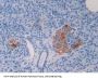 C-X-C Motif Chemokine 5 / ENA-78 (CXCL5) Antibody