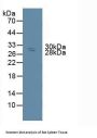 Non Metastatic Cells 6, Protein Expressed In (NME6) Antibody