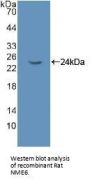 Non Metastatic Cells 6, Protein Expressed In (NME6) Antibody