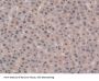 Non Metastatic Cells 6, Protein Expressed In (NME6) Antibody