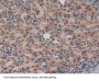 Non Metastatic Cells 6, Protein Expressed In (NME6) Antibody