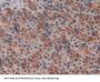 Non Metastatic Cells 6, Protein Expressed In (NME6) Antibody