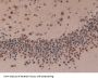 Non Metastatic Cells 6, Protein Expressed In (NME6) Antibody
