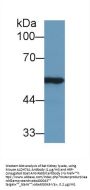 Aldehyde Dehydrogenase 7 Family, Member A1 (ALDH7A1) Antibody