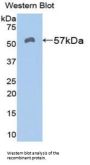 Aldehyde Dehydrogenase 7 Family, Member A1 (ALDH7A1) Antibody
