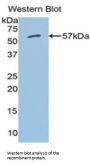 Aldehyde Dehydrogenase 7 Family, Member A1 (ALDH7A1) Antibody
