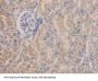 Aldehyde Dehydrogenase 7 Family, Member A1 (ALDH7A1) Antibody