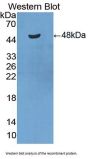 Platelet/Endothelial Cell Adhesion Molecule (PECAM1) Antibody