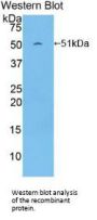 Platelet/Endothelial Cell Adhesion Molecule (PECAM1) Antibody
