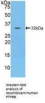Protein Tyrosine Phosphatase Receptor Type B (PTPRB) Antibody