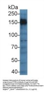 Receptor-Type Tyrosine-Protein Phosphatase C / CD45 (PTPRC) Antibody