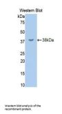 Receptor-Type Tyrosine-Protein Phosphatase C / CD45 (PTPRC) Antibody