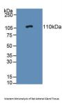 Protein Tyrosine Phosphatase Receptor Type N (PTPRN) Antibody