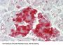 Protein Tyrosine Phosphatase Receptor Type N (PTPRN) Antibody
