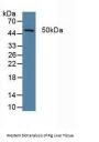 Xeroderma Pigmentosum, Complementation Group G (XPG) Antibody
