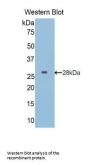 Insulin Like Growth Factor Binding Protein 5 (IGFBP5) Antibody