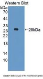 Insulin Like Growth Factor Binding Protein 6 (IGFBP6) Antibody