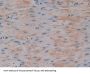 Insulin Like Growth Factor Binding Protein 6 (IGFBP6) Antibody