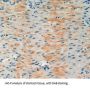 Insulin Like Growth Factor Binding Protein 6 (IGFBP6) Antibody