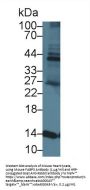 Fatty Acid Binding Protein 3, Muscle And Heart (FABP3) Antibody