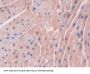 Fatty Acid Binding Protein 3, Muscle And Heart (FABP3) Antibody