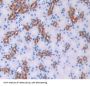 Fatty Acid Binding Protein 3, Muscle And Heart (FABP3) Antibody