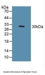 Fc Fragment of IgG Low Affinity IIIa Receptor (FCGR3A) Antibody