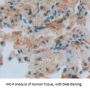 Fc Fragment of IgG Low Affinity IIIa Receptor (FCGR3A) Antibody