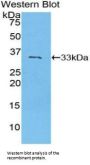 P2Y Purinoceptor 13 (P2RY14) Antibody