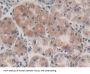 P2Y Purinoceptor 13 (P2RY14) Antibody
