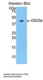 Vascular Endothelial Growth Factor Receptor 1 / VEGFR1 (FLT1) Antibody
