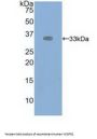 Vascular Endothelial Growth Factor Receptor 2 / VEGFR2 (KDR) Antibody