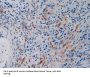Vascular Endothelial Growth Factor Receptor 2 / VEGFR2 (KDR) Antibody