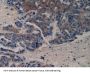 Vascular Endothelial Growth Factor Receptor 2 / VEGFR2 (KDR) Antibody