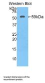 17-Beta-Hydroxysteroid Dehydrogenase Type 12 (HSD17B12) Antibody