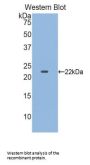 Colony Stimulating Factor Receptor, Granulocyte (GCSFR) Antibody