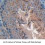 Colony Stimulating Factor Receptor, Granulocyte (GCSFR) Antibody