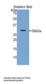 Electron Transfer Flavoprotein Alpha Polypeptide (ETFa) Antibody