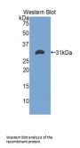 Electron Transfer Flavoprotein Alpha Polypeptide (ETFa) Antibody