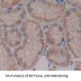 Electron Transfer Flavoprotein Alpha Polypeptide (ETFa) Antibody