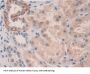 Killer Cell Immunoglobulin Like Receptor 2DL3 (KIR2DL3) Antibody