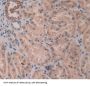 Killer Cell Immunoglobulin Like Receptor 2DL3 (KIR2DL3) Antibody