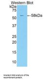Killer Cell Immunoglobulin Like Receptor 2DS2 (KIR2DS2) Antibody