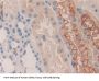Killer Cell Immunoglobulin Like Receptor 2DS2 (KIR2DS2) Antibody