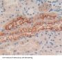 Killer Cell Immunoglobulin Like Receptor 2DS2 (KIR2DS2) Antibody