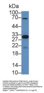 Killer Cell Immunoglobulin Like Receptor 2DS4 (KIR2DS4) Antibody